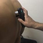 دستگاه آنالیز ستون فقرات (CTL Scan) 3