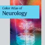 Color Atlas of Neurology 2004 (Malestrom)_1